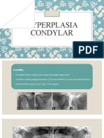 Hyperplasia Condyle