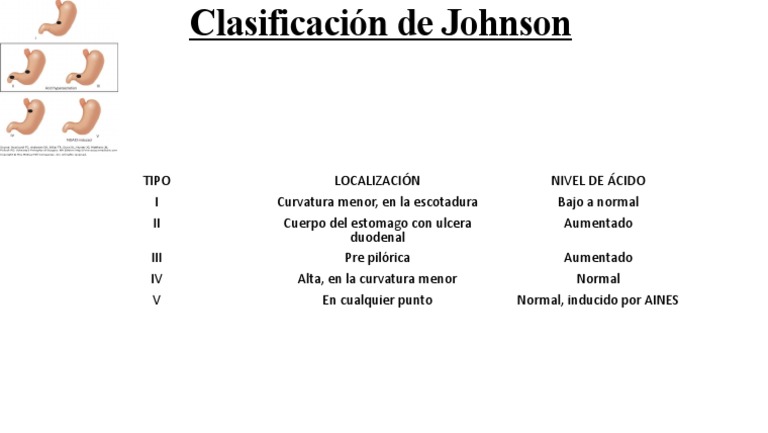 Clasificación de Johnson en Úlceras Pépticas | PDF | Cocina, comidas y ...
