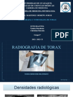 Radiografia y Tomografia de Torax