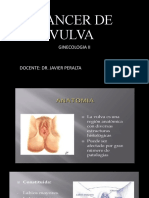 Cancer de Vulva Tema 1