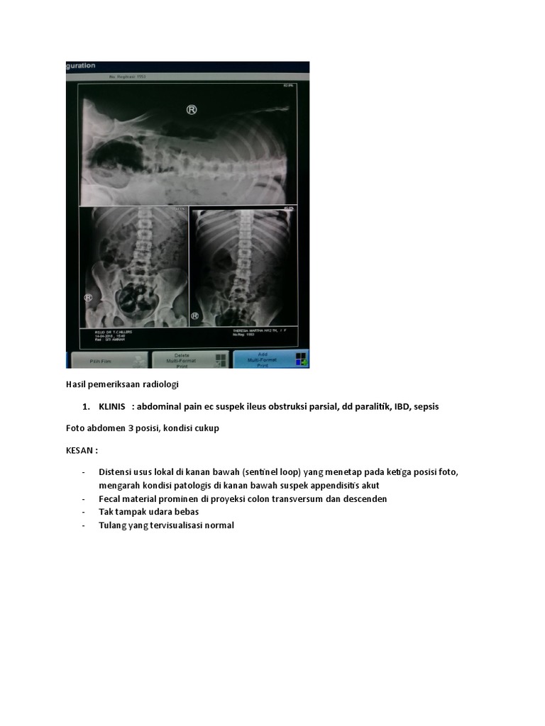 Hasil Radiologi: Temuan Patologis Utama | PDF | Sains & Matematika