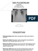 Dokumen.tech Ppt Referat Edema Pulmonum