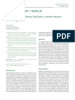 Subtrochanteric Femur Fractures: Current Review of Management