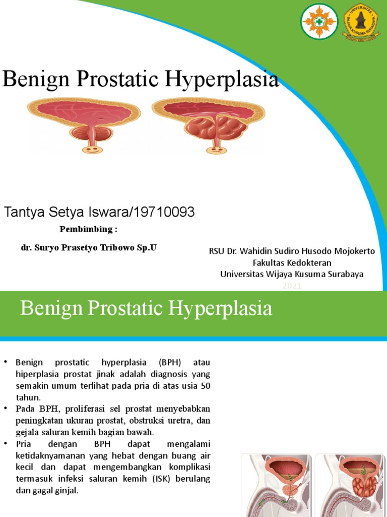 Yalangoch ginekologik tekshiruv video