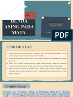 Benda Asing Pada Konjungtiva Fix