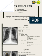 Tilikan Tumor Paru