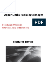 4# Upper Limb Injuries