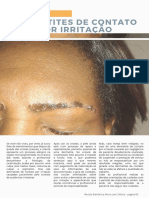 Dermatites de Contato Por Irritação Durante o Processo de Cicatrização Das Sobrancelhas Micropigmentadas