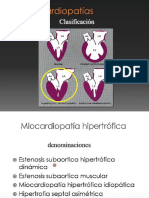 Miocardiopatías Teórica 2