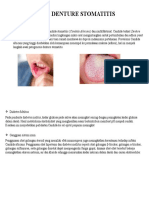 Patogenesis Denture Stomatitis
