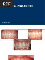 Edentulous Alveolar Ridge | PDF