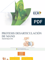 Protesis Desarticulación Mano