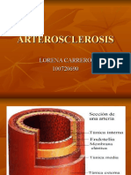 Arterosclerosis: causas, tipos y síntomas