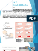 7.-Formula Leucocitaria