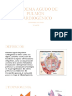 El Edema Pulmonar Cardiogenico Valdine y Emmanuelle