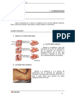 QUEMADURAS