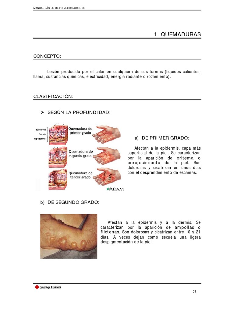 Clasificación y manejo de quemaduras | PDF | Piel | Quemar