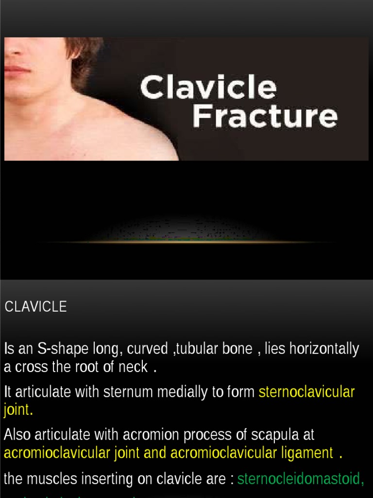 Clavicle Fracture | PDF | Shoulder | Injury