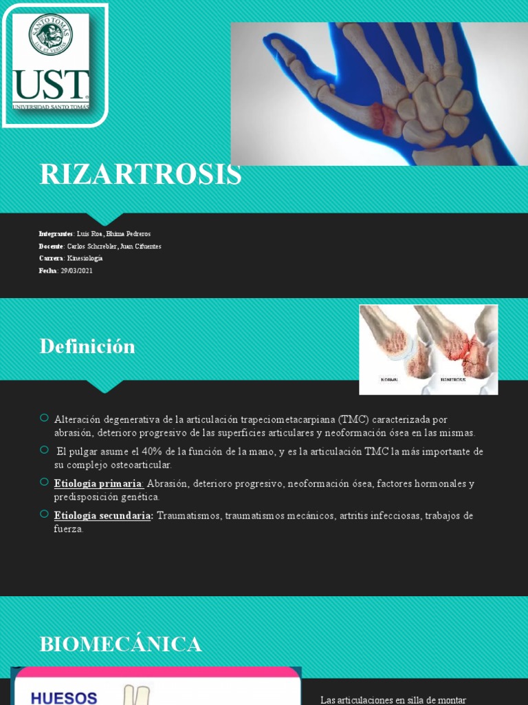RIZARTROSIS | PDF | Articulación | Trastornos musculoesqueléticos