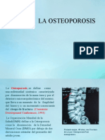 Tema Osteoporosis