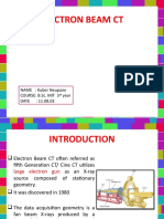 Electron Beam CT