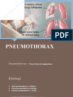 Pneumothorax-PPT