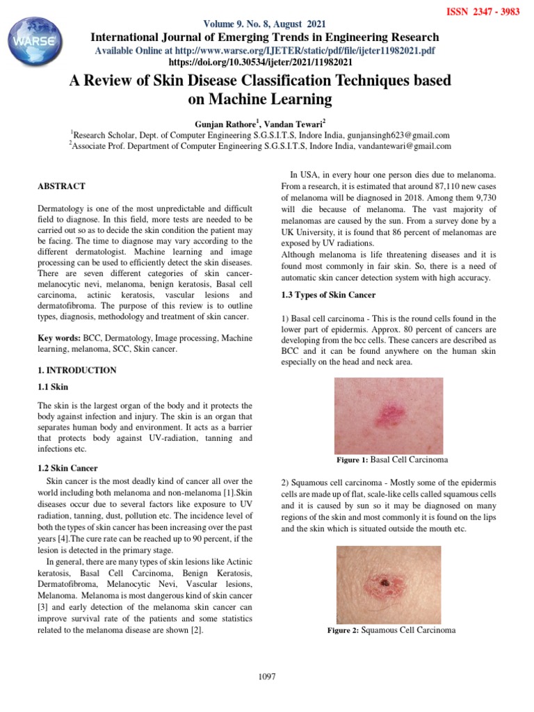 Machine Learning in Skin Cancer Detection | PDF | Melanoma | Skin Cancer