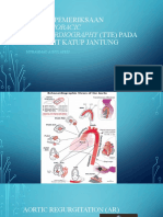 TTE Pada Regurgitasi Aorta