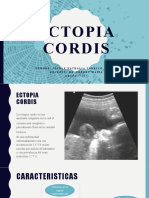 Ectopia Cordis