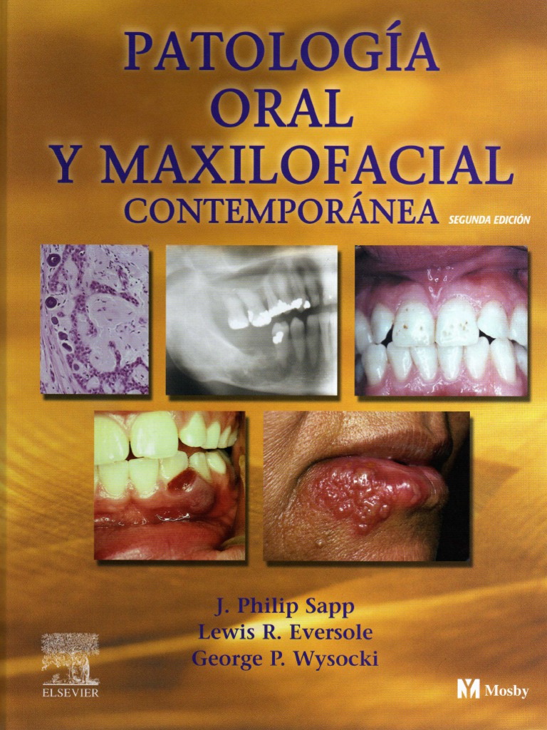 Patologìa Oral y Maxilofacial Contemporànea. | PDF | Diente ...