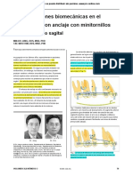 Consideraciones Biomecanicas en El Tratamiento Con Minitornillos-I.en - Es