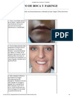 Examen Fisico de Boca y Faringe