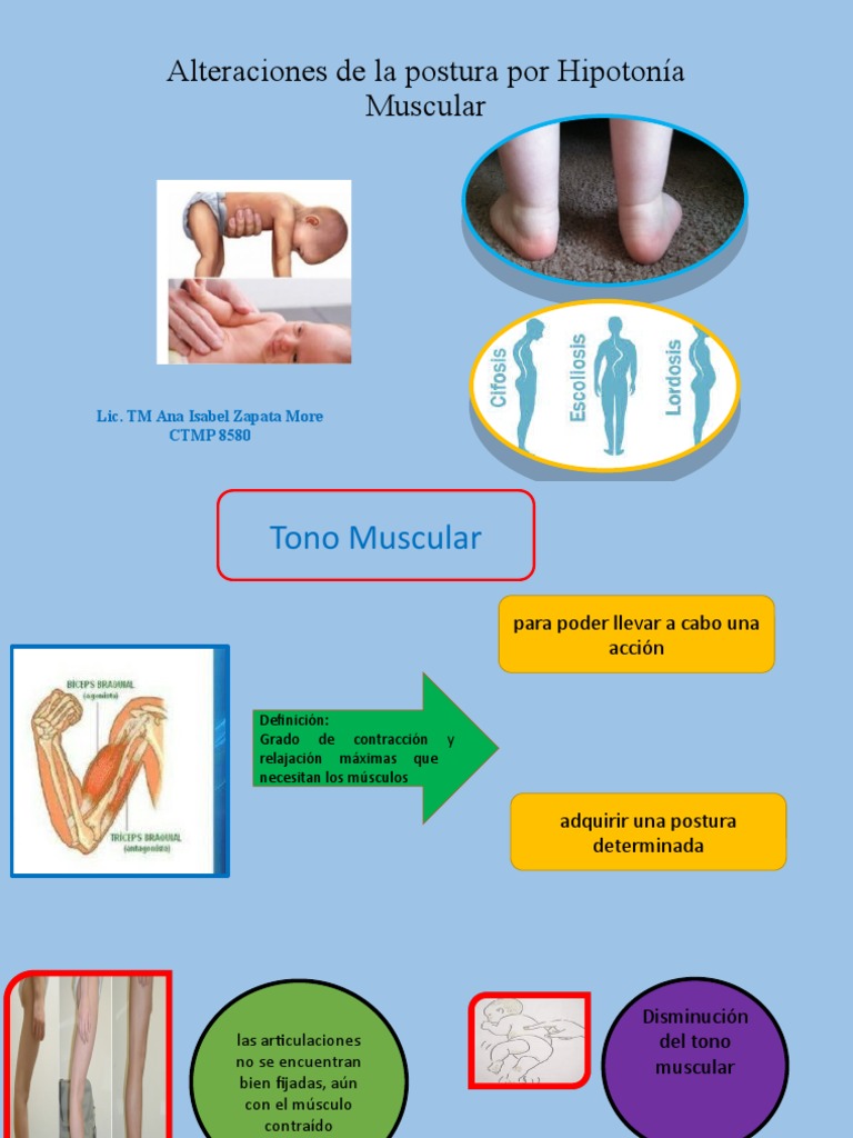 Alteraciones de La Postura Por Hipotonía Muscular | PDF ...