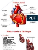 Flutter Atrial