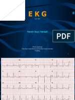 P Ekg