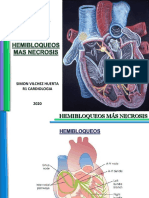 Hemibloqueos Mas Necrosis Simon