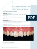 Consideraciones Periodontales para Las Restauraciones Dentales