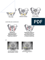 Imaginer Pelvic Line Dan Pemeriksaan X-Ray Acetabulum