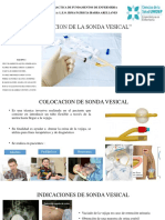 Colocación de Sonda Vesical (Enfermerìa)