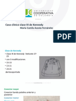 Protesis Parcial Removible Caso Clinico CAMI