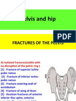 DISLOCATIONS AND FRACTURE-DISLOCATIONS OF THE HIP