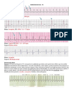 ECG Exercises - Interpretation and Treatment