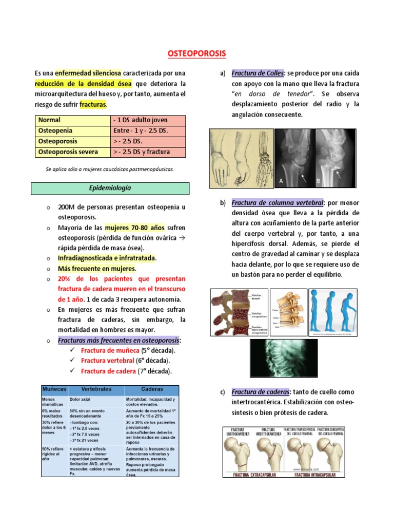 Osteoporosis: Riesgos y Fracturas Comunes | PDF | Osteoporosis ...