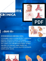 Bronquitis Crónica: Causas, Síntomas y Tratamiento