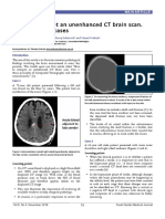 How to interpret CT brain scans