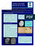 Poster Ganglioglioma