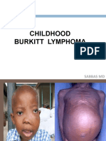Childhood Burkitt Lymphoma: Sabbas MD