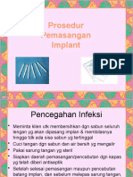 Prosedur Pemasangan Implant
