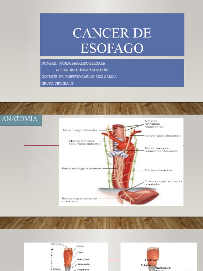 Fisiopatología y Tratamiento del Cáncer de Esófago | PDF | Cáncer de ...