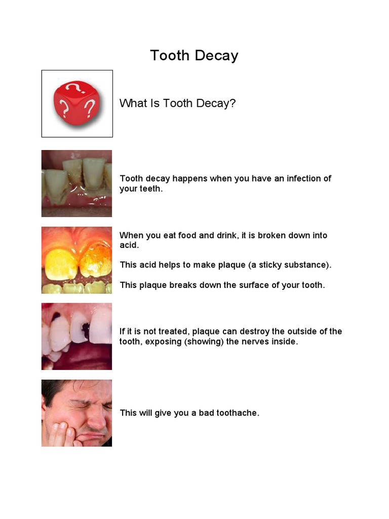 The Ultimate Guide To 51 Tooth Dental Haus - i1n0j2f